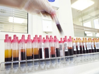 Blutbank des Universitätsklinikums Leipzig bietet Blutspendern Antikörpertestung an